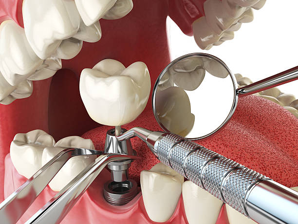 Best Emergency Treatment for Oral Infections in Bainbridge, GA