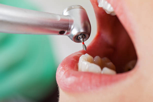 Best Lost Filling or Crown Replacement in Bainbridge, GA